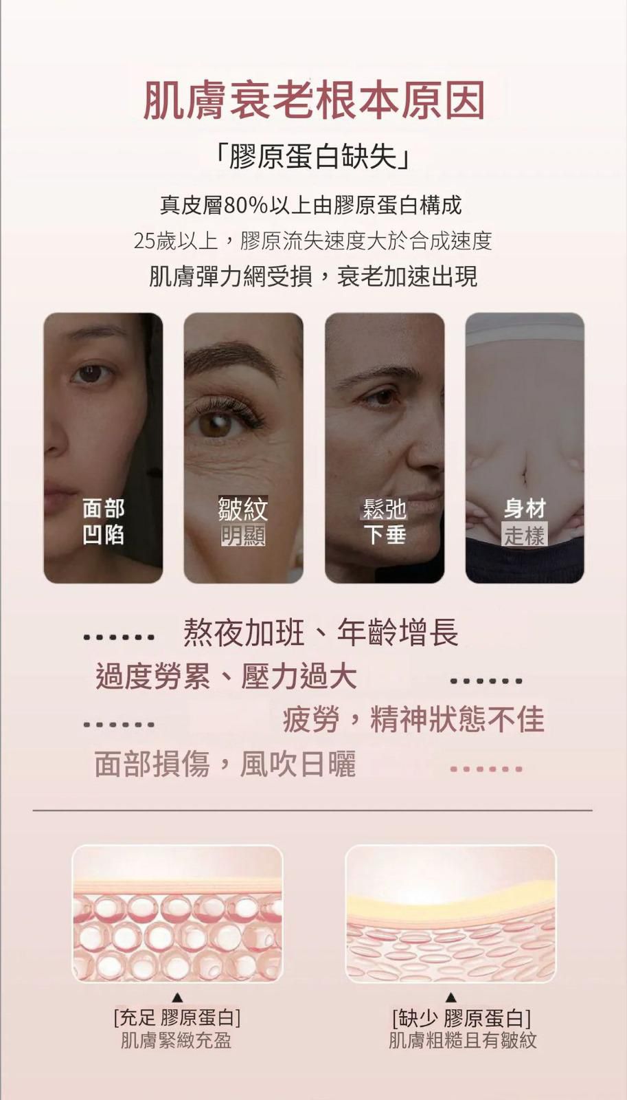 ILO - Type 1 膠原蛋白安瓶 - 28日份