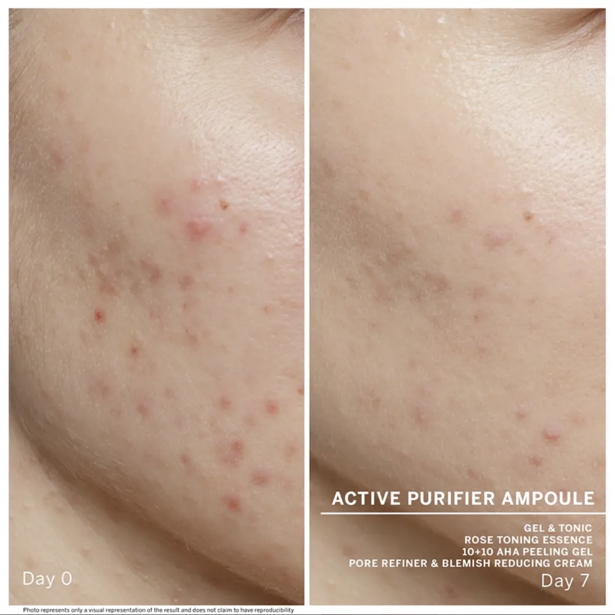 🇩🇪德國BABOR ACTIVE PURIFIER 茶樹抗菌消痘安瓶(2ML X 7支）