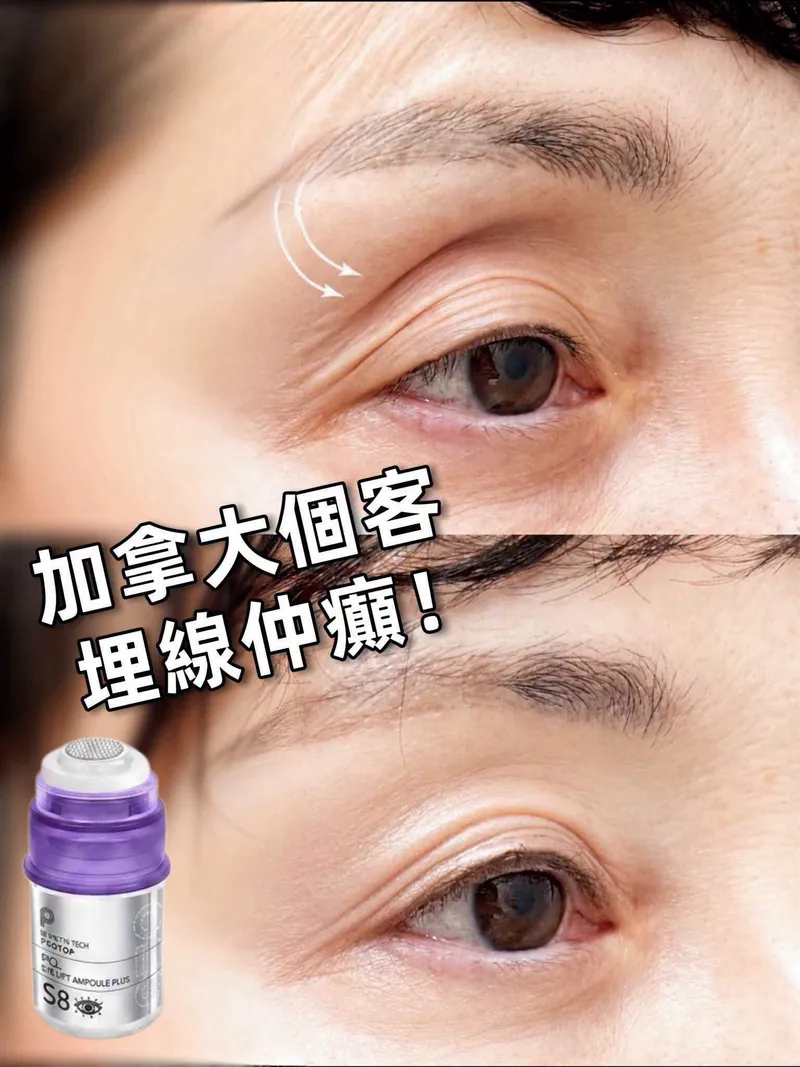 韓國🇰🇷PROTOP S8 PCL 眼部精華(一支3ML)