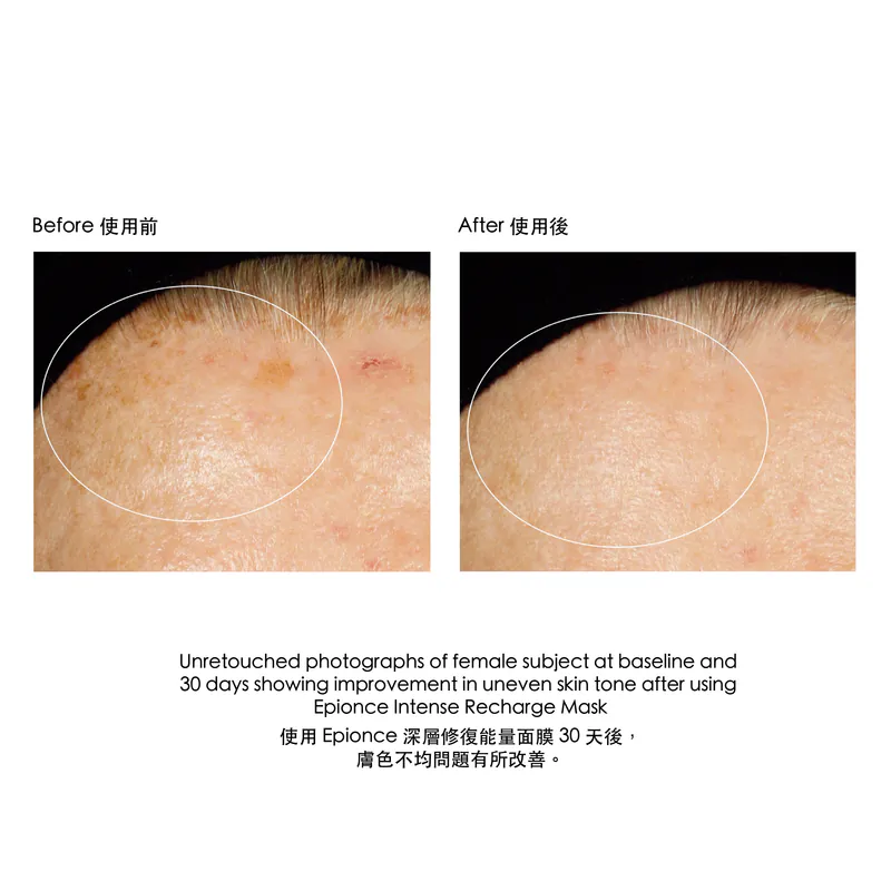 Epionce Intense Recharge Mask 深層修復能量面膜 BBE 9/26