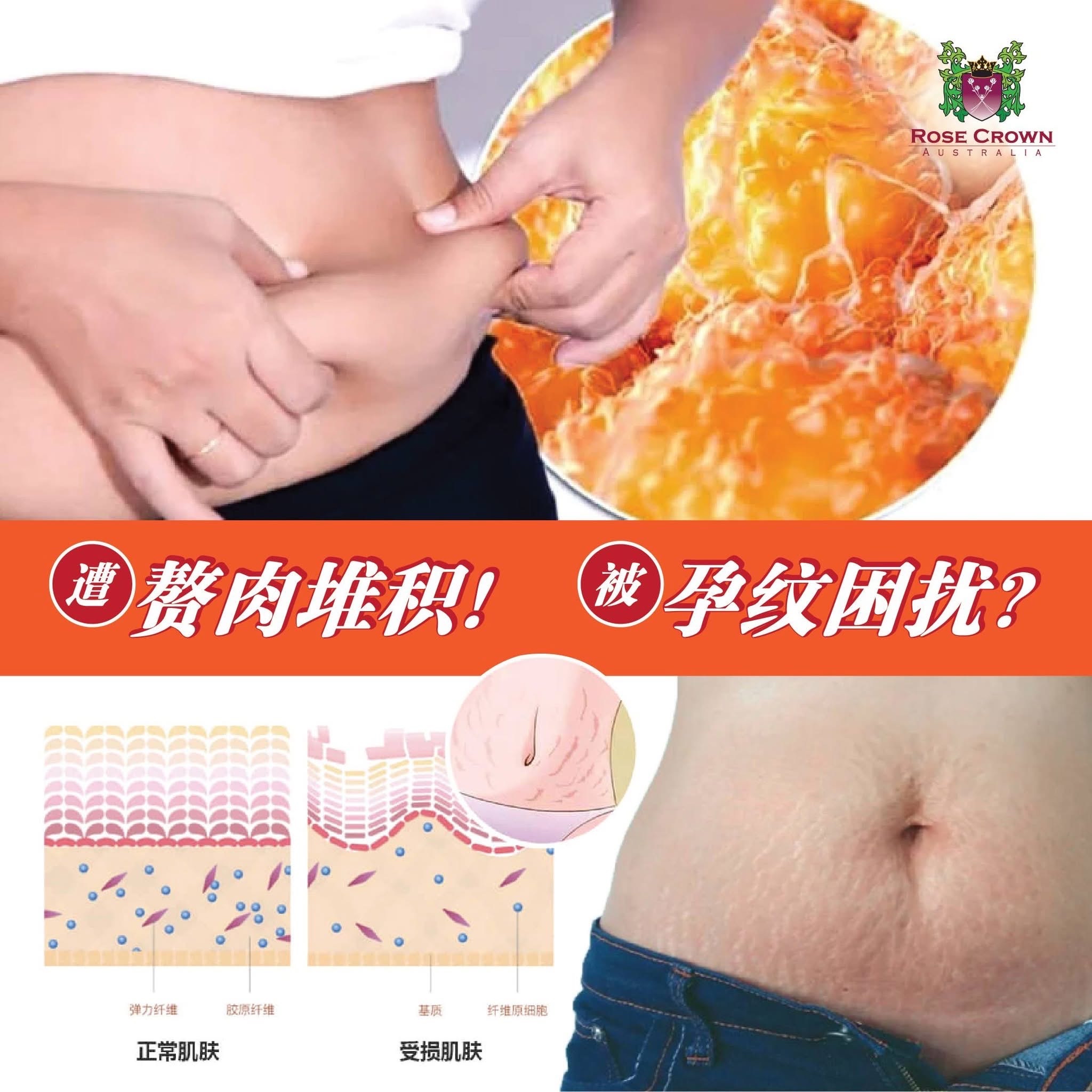 Rose Crown Cellutox 100ml