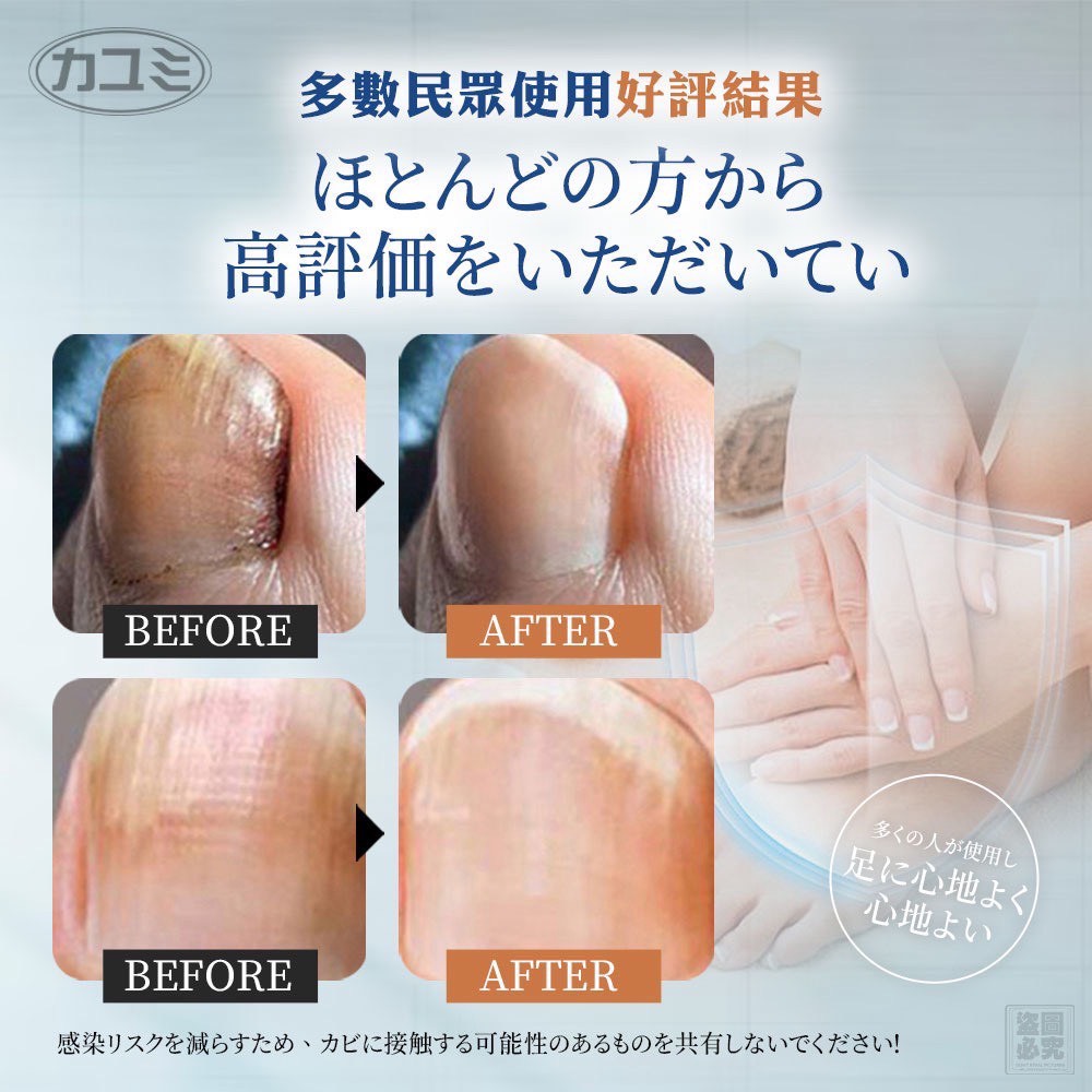 日本カユミ 修護型灰甲專用滴劑30ml