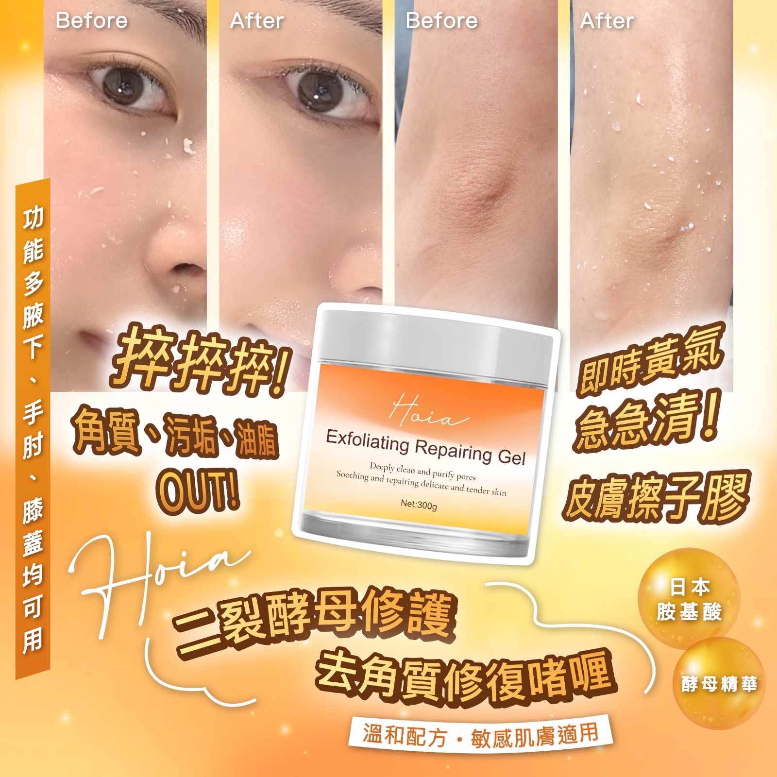 Hoia 二裂酵母修護去角質啫喱 2.0