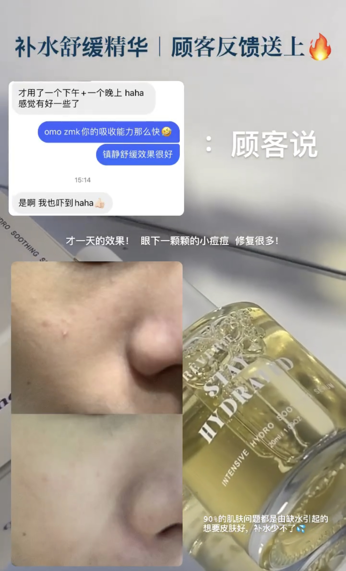 REVERIE补水舒缓精华液