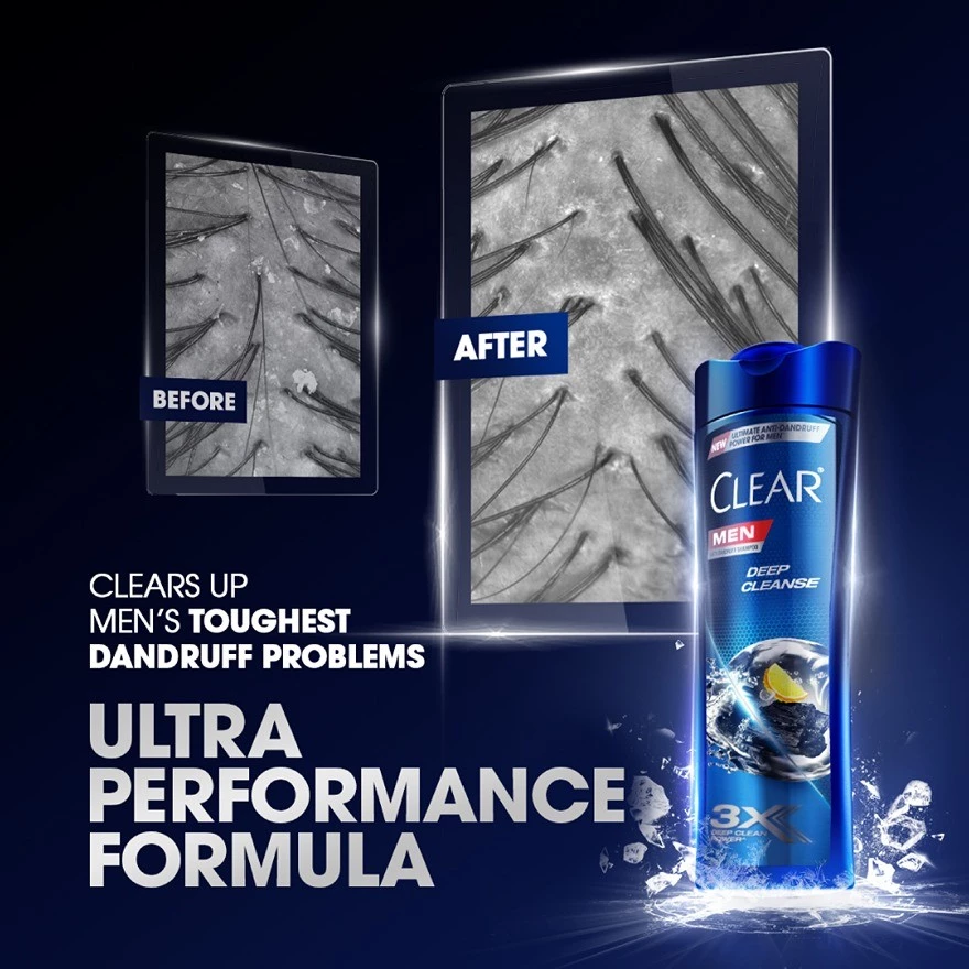 Clear Men Shampoo 315ml / 300ml Deep Cleanse
