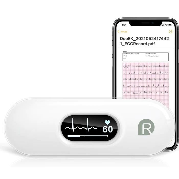 Wellue - Portable ECG Monitor with OLED Screen [AD0191