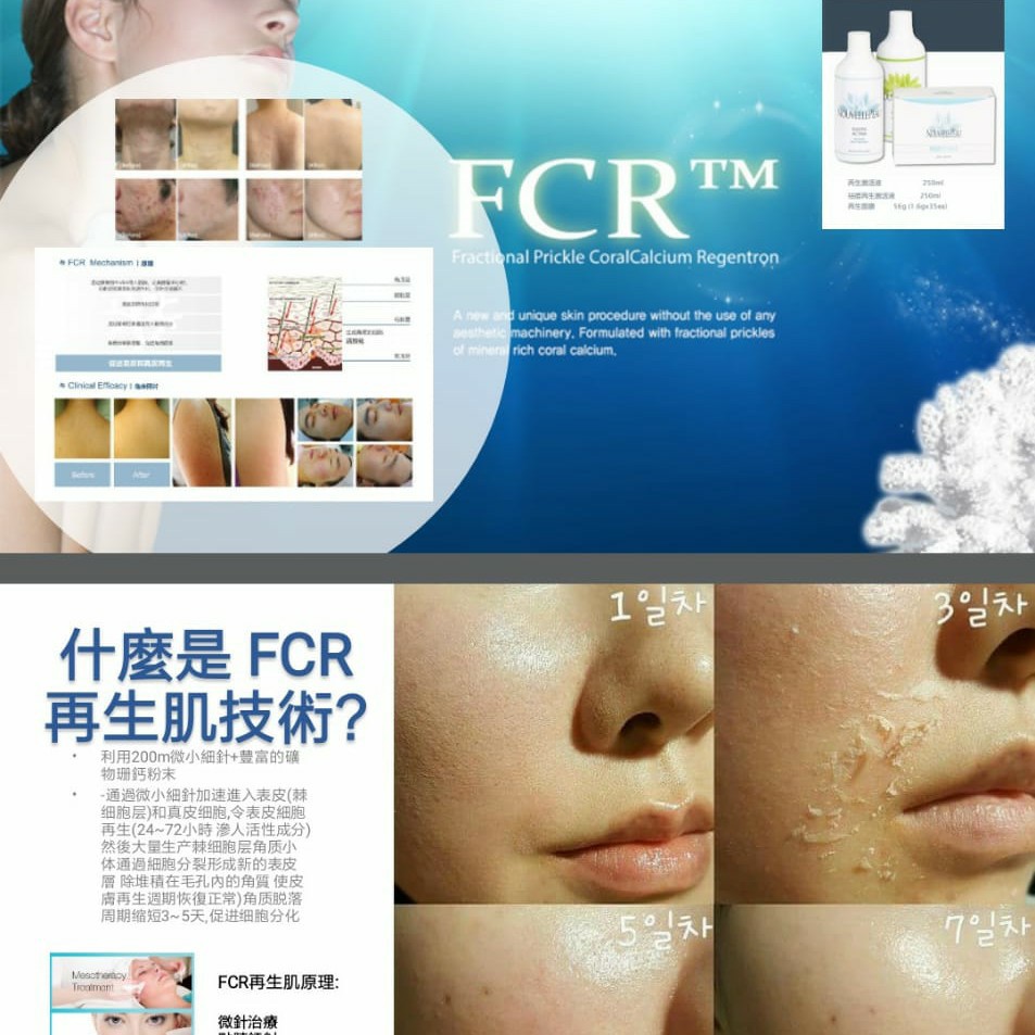 陶瓷肌 珊瑚針 1套做2次  tHermo Ceutical NOUVELLE PE`AU