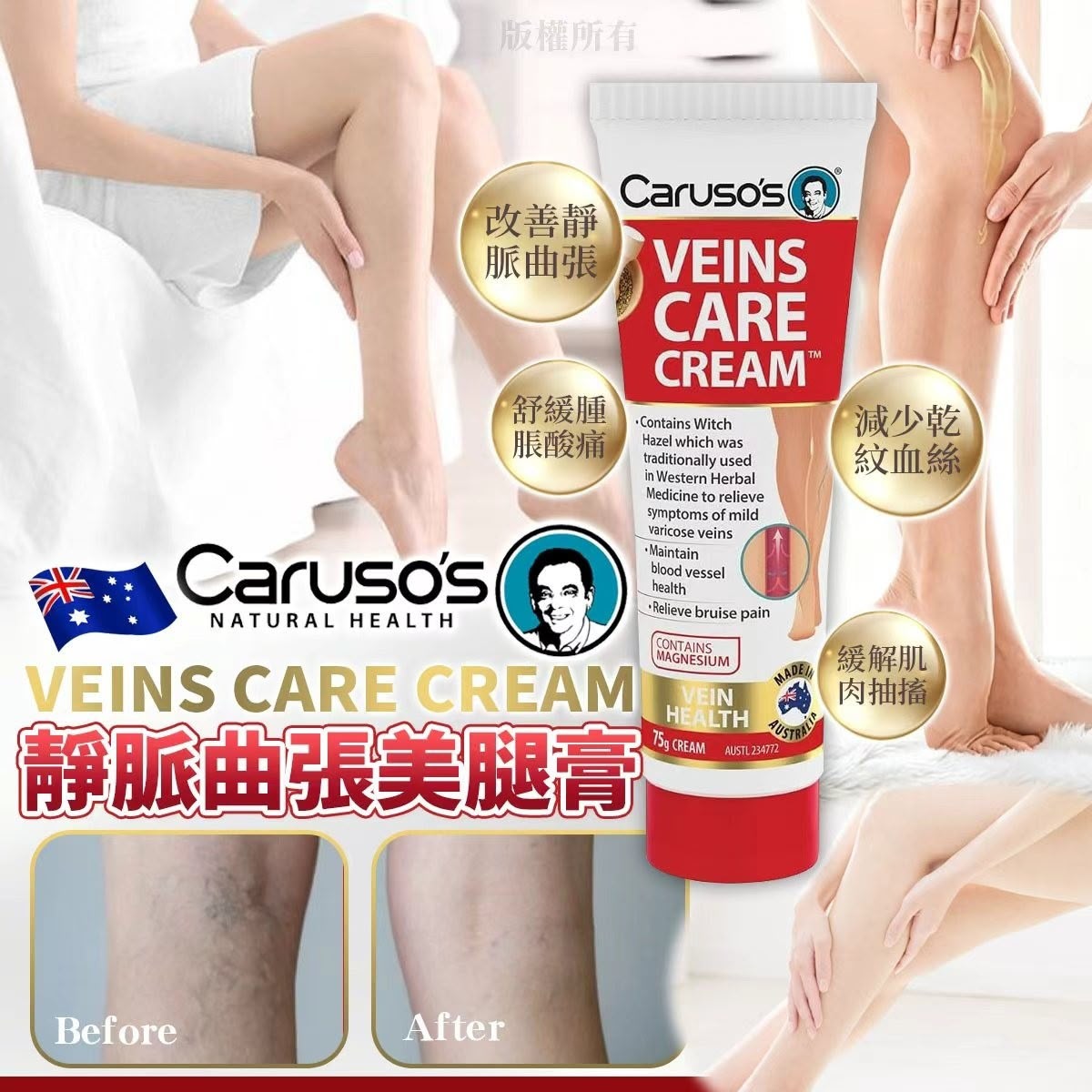 ＜限時預購＞ 澳洲 Caruso's Veins Care Cream 靜脈曲張美腿膏75g TW260915L02 《16/9截單，預計10月下旬到港》
