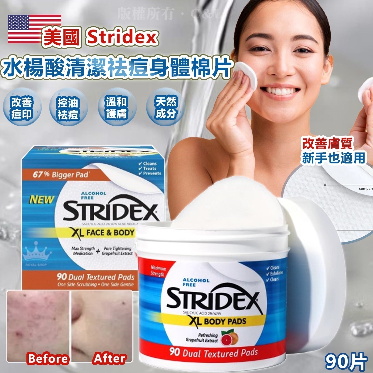 美國 Stridex 水楊酸清潔祛痘身體棉片90片