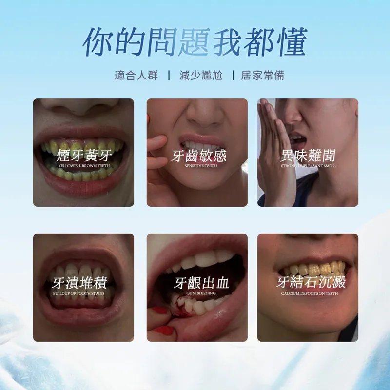 ⏰30/3 MIZU 益生菌礦鹽除漬牙膏110g(一組三條) (團購約8月初到港)