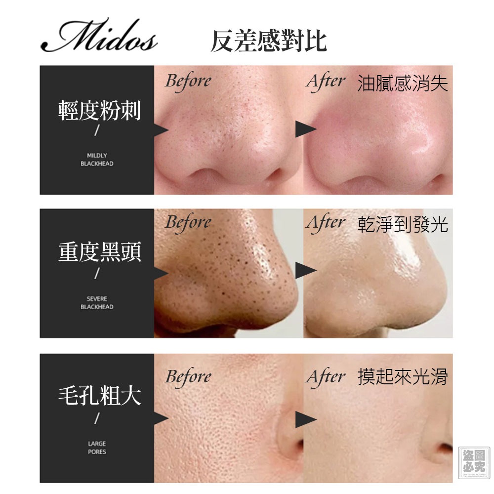 Midso 粉刺導出洗面乳-贈送導出皂