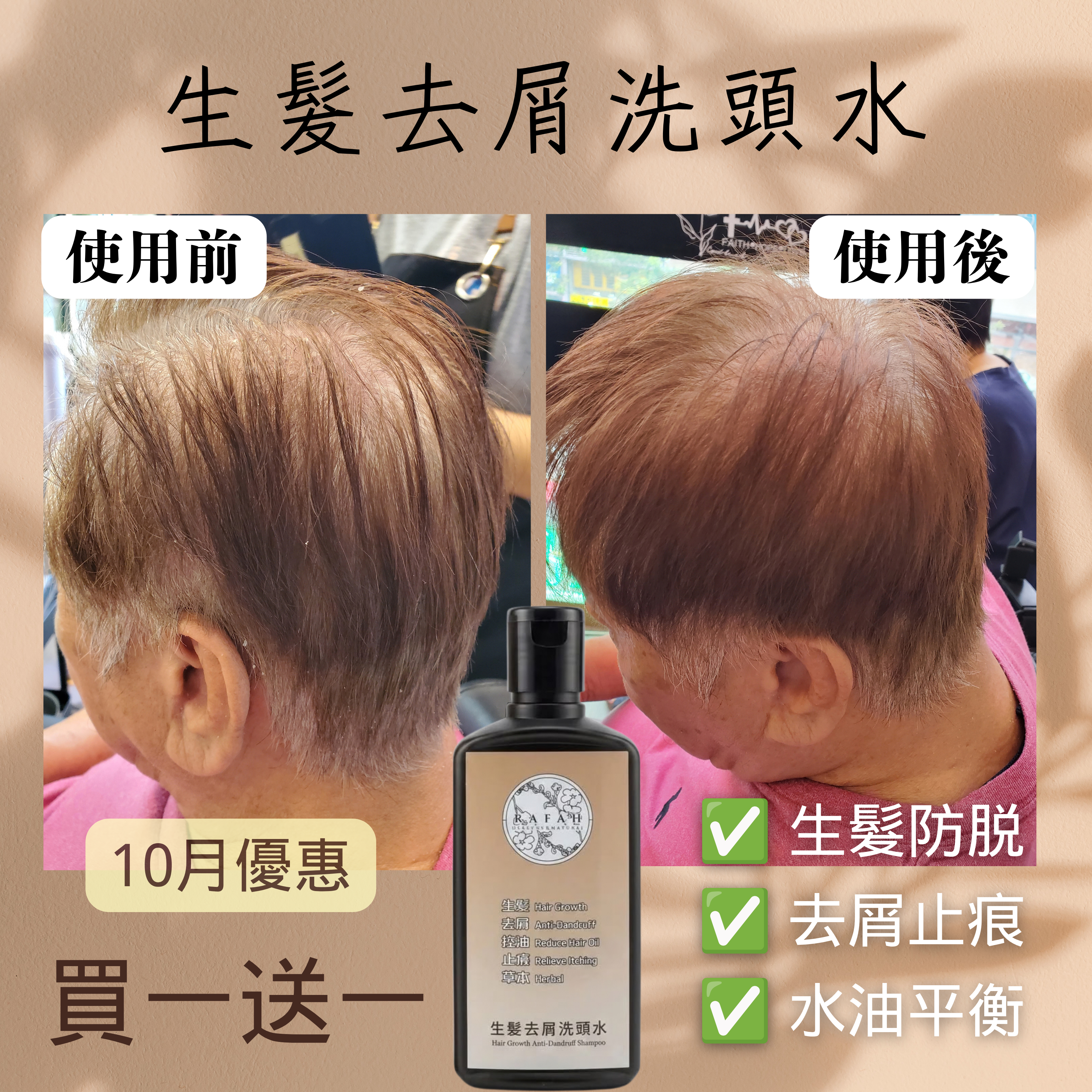 生髮去屑洗頭水*買1送1*