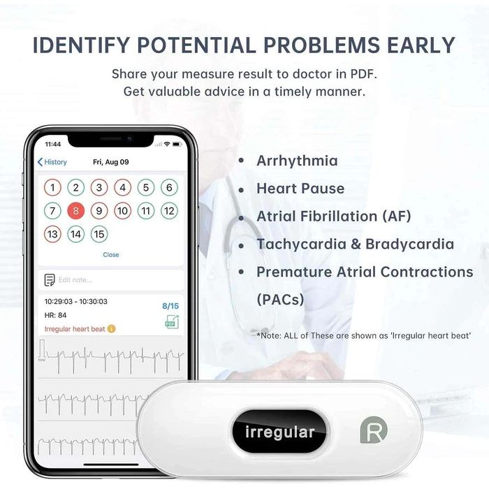 Wellue - Portable ECG Monitor with OLED Screen [AD0191