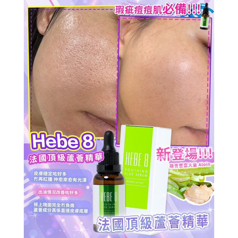 HEBE 8 法國頂級蘆薈抗敏退炎精華30ML  (訂貨4-7天)