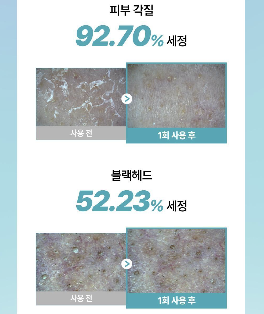 升級配方｜韓國 ilso X 土豆熊 超融化油脂 溫和清毛孔 卸妝油 200ml + 送土豆熊髮圈｜Super Melting Sebum Cleansing Oil