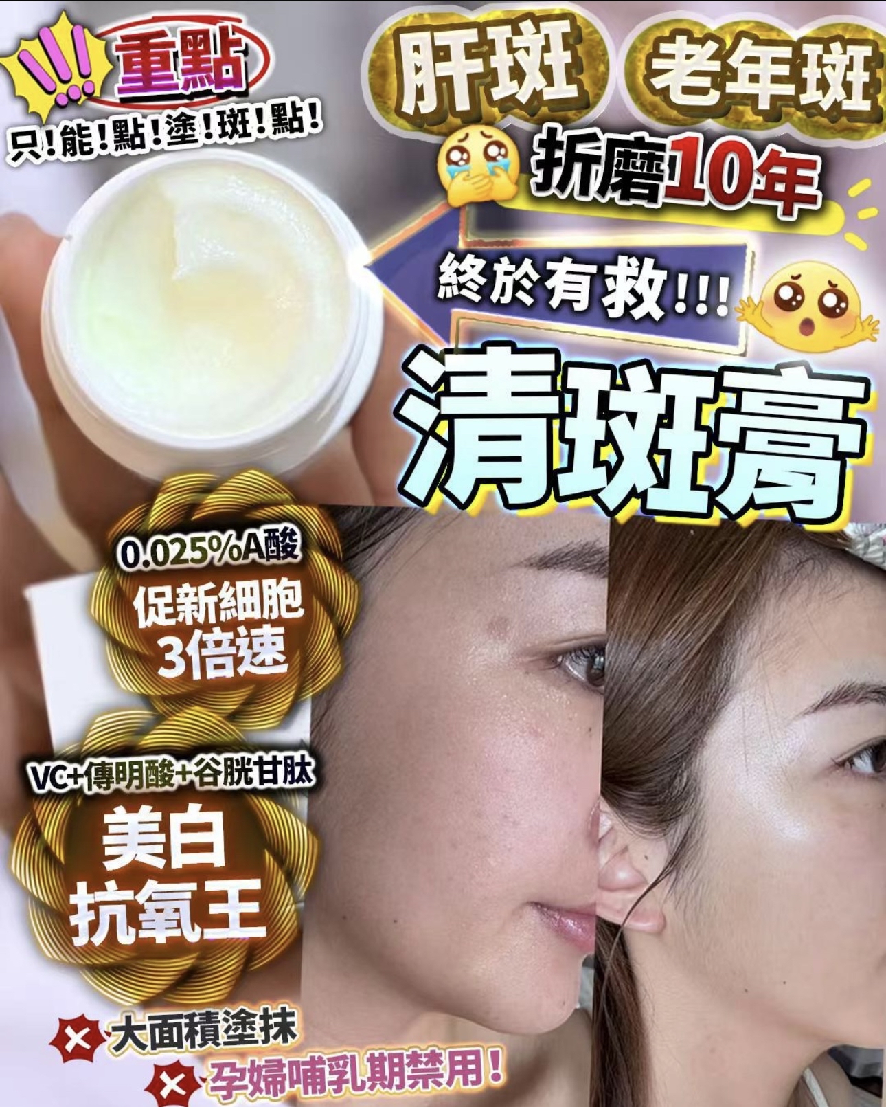 清斑膏 15g 重點塗抹 