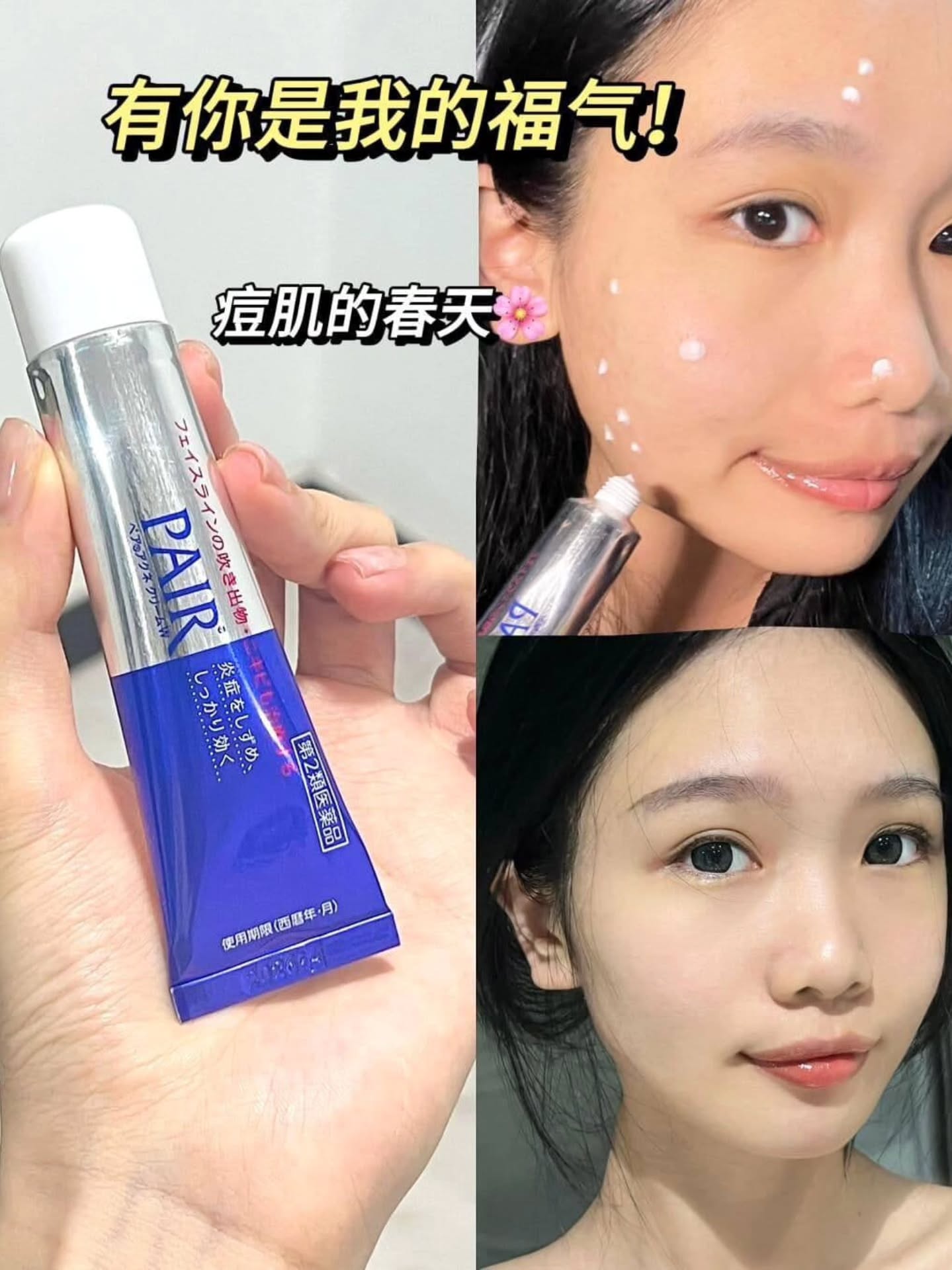 🇯🇵【日本 Pair Acne Cream 痘痘膏】