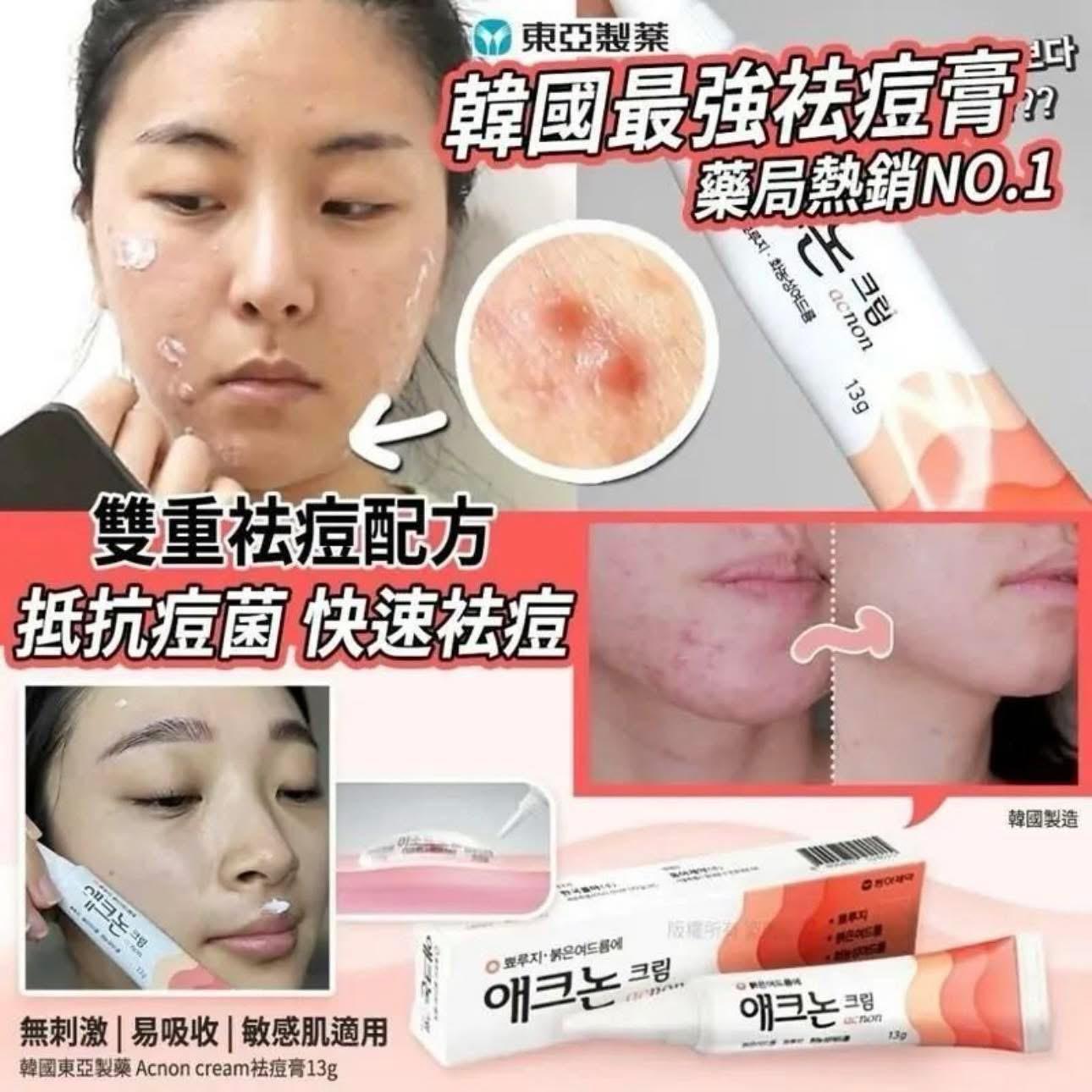 東亞製藥 Acnon Cream