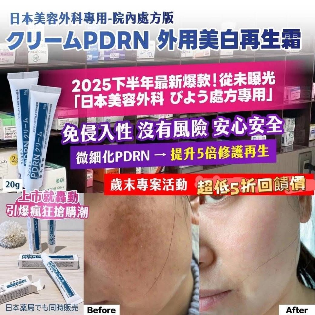 🇯🇵日本美容外科專用-院內處方版 クリームPDRN 外用美白再生霜 20g
