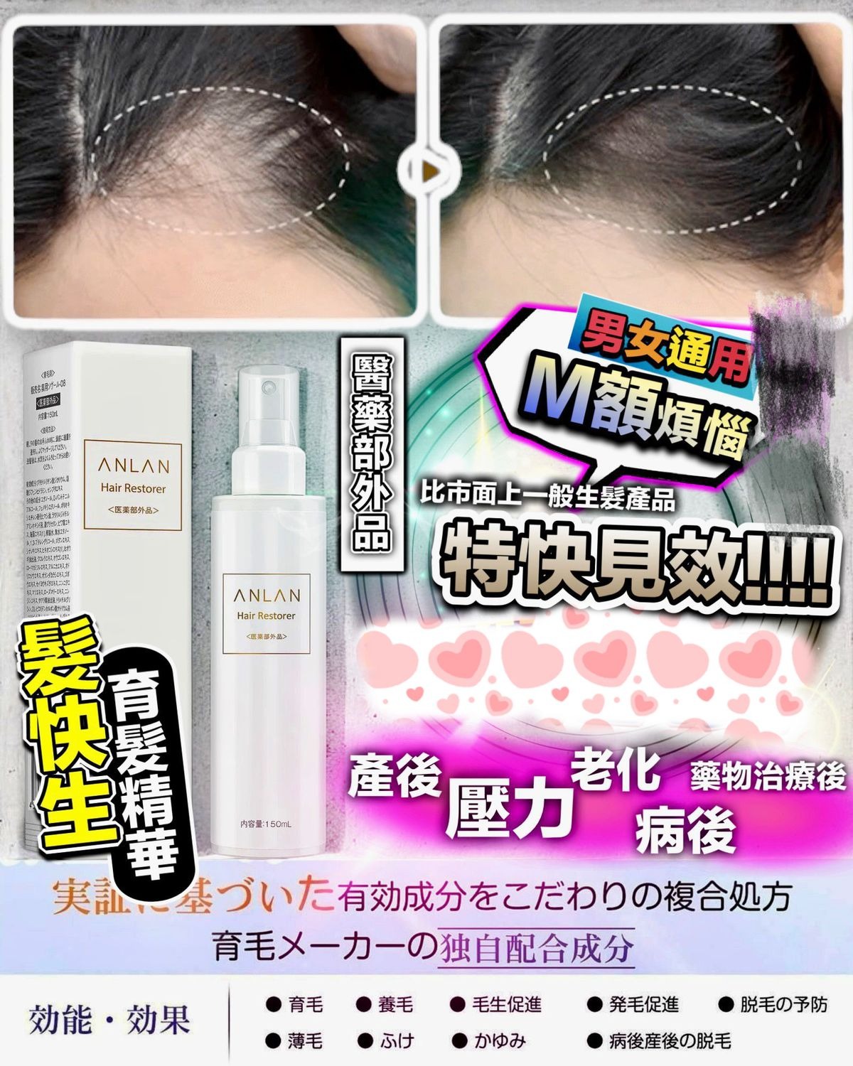 日本🇯🇵ANLAN🇯🇵髮快生 育髮精華150ml