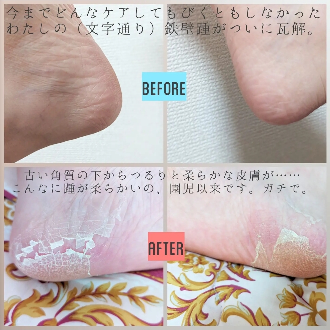 日本Dr.Scholl 專業護理腳跟去角質足膜 1足回分