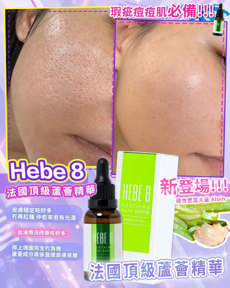 HEBE 8 積雪草控油面膜 ＋ 頂級蘆薈舒緩精華 套裝優惠