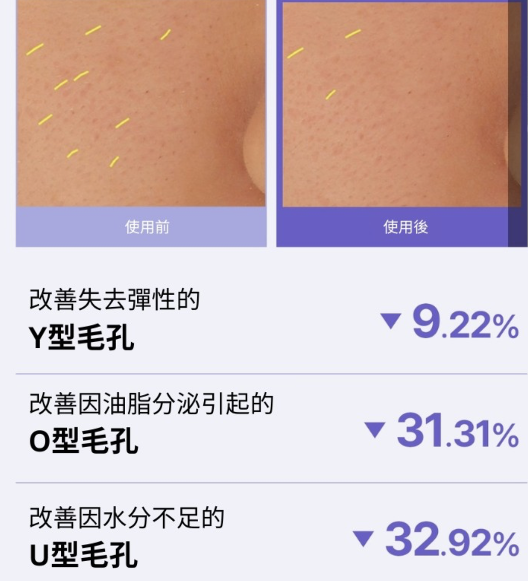 韓國 REJURAN 麗珠蘭 毛孔緊緻 水凝膠面膜 5片 / 盒｜ Pore Tightening Gel Mask