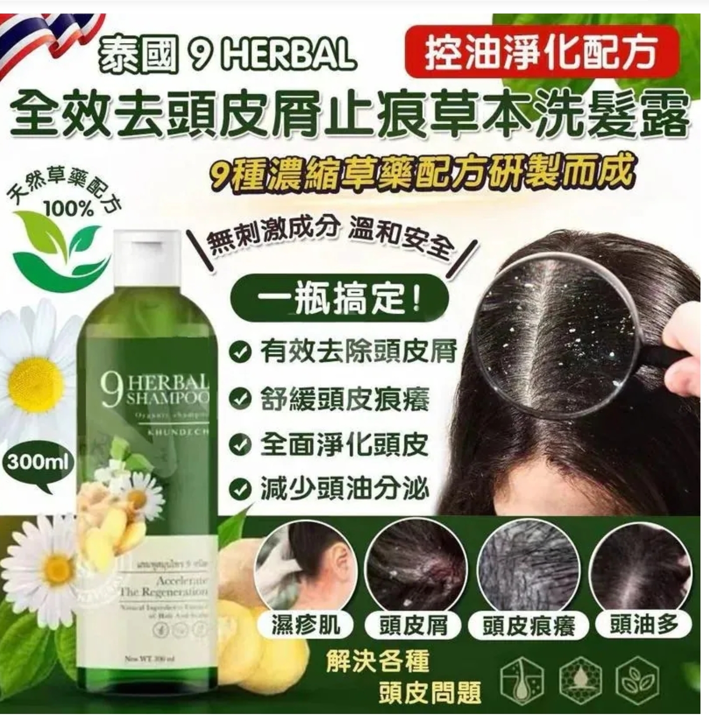$65支.2支以上$55支.泰國9 HERBAL 全效去頭皮屑止痕草本洗髮露 (控油淨化配方) 300ml