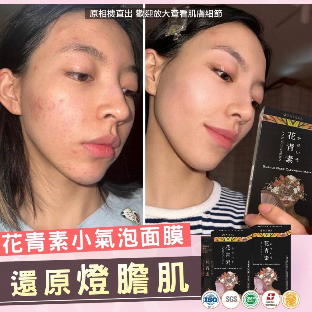 𝐅𝐚𝐭𝐞𝐫𝐚花青素小氣泡面膜（一盒10片）