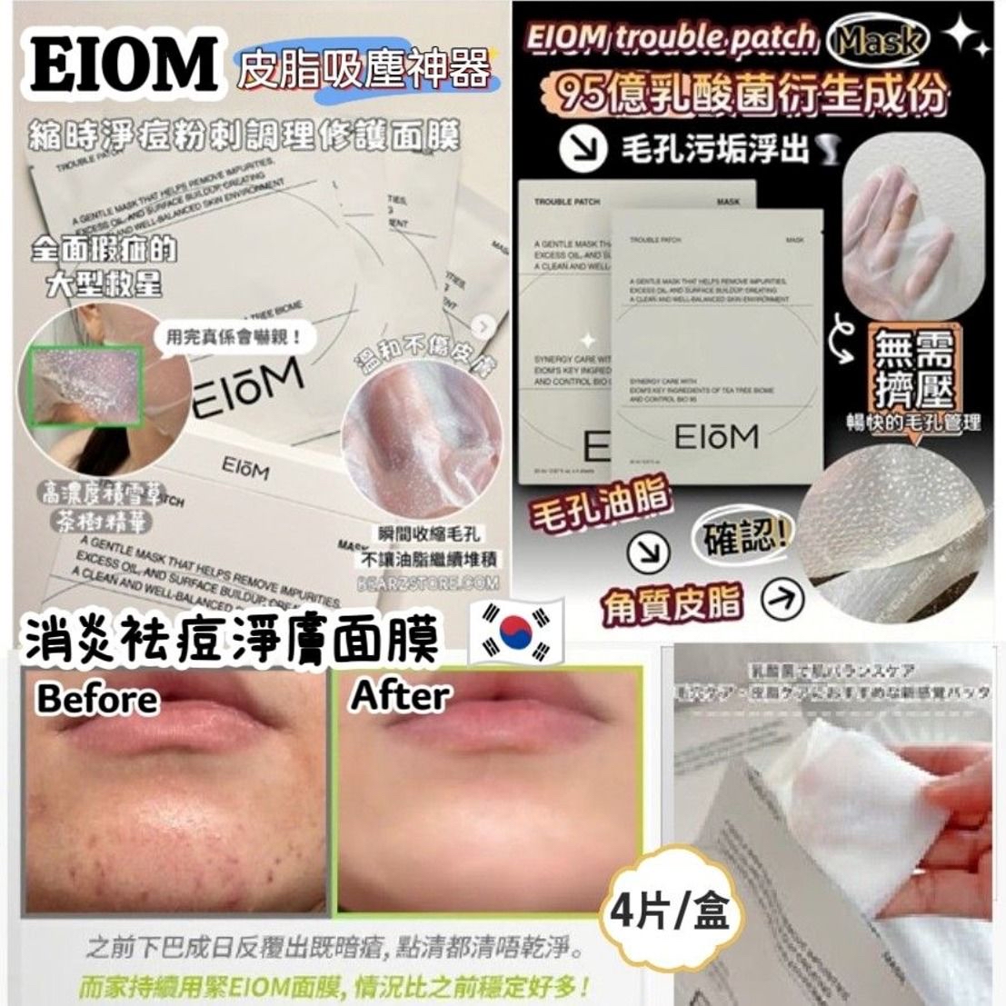  韓國 Eiom Trouble Patch Mask 消炎祛痘 淨膚面膜 (4片/盒）