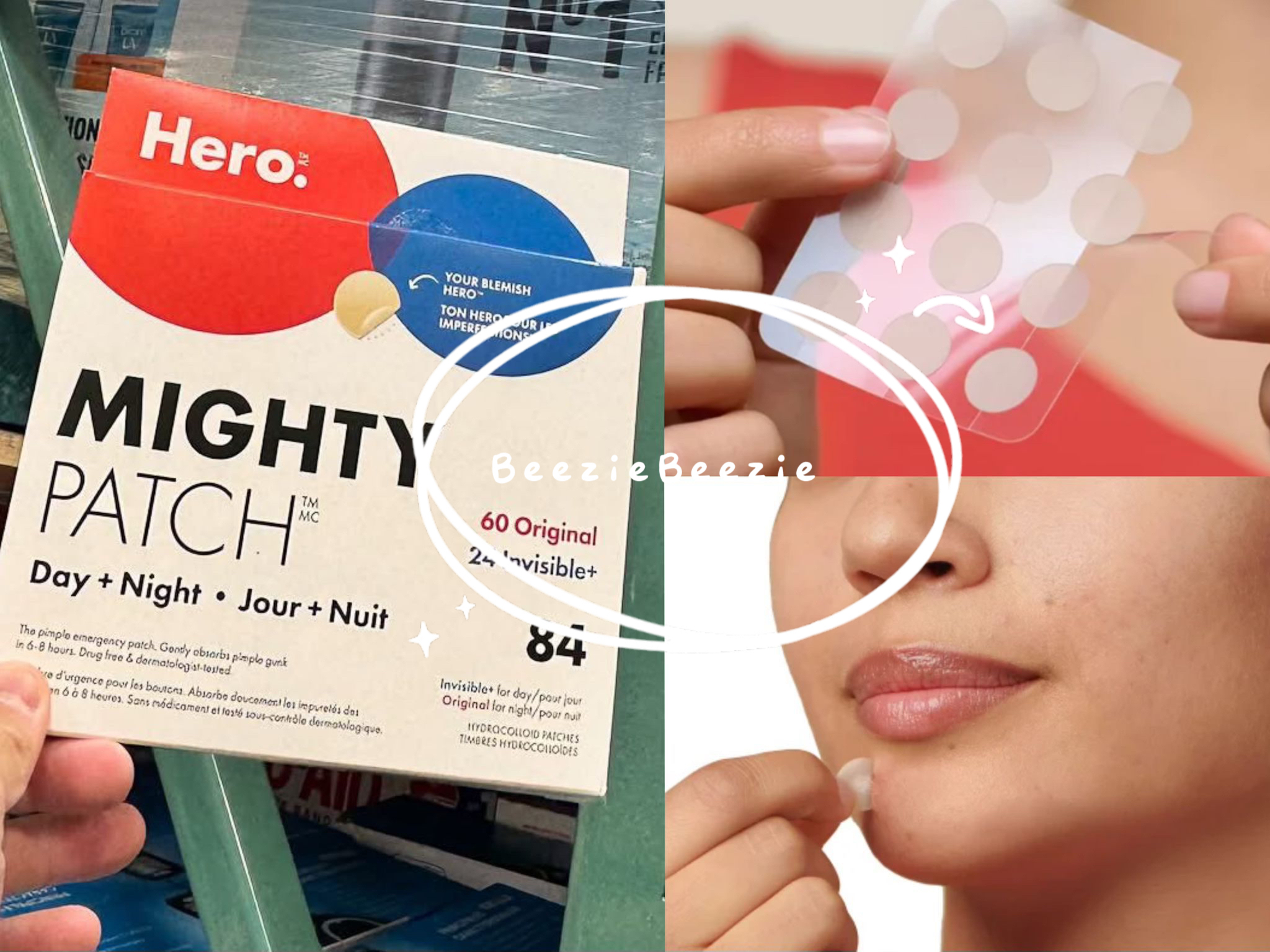 (預購 - 3月13號截單) Hero Mighty Patch 雙效淨痘貼 (84 貼）