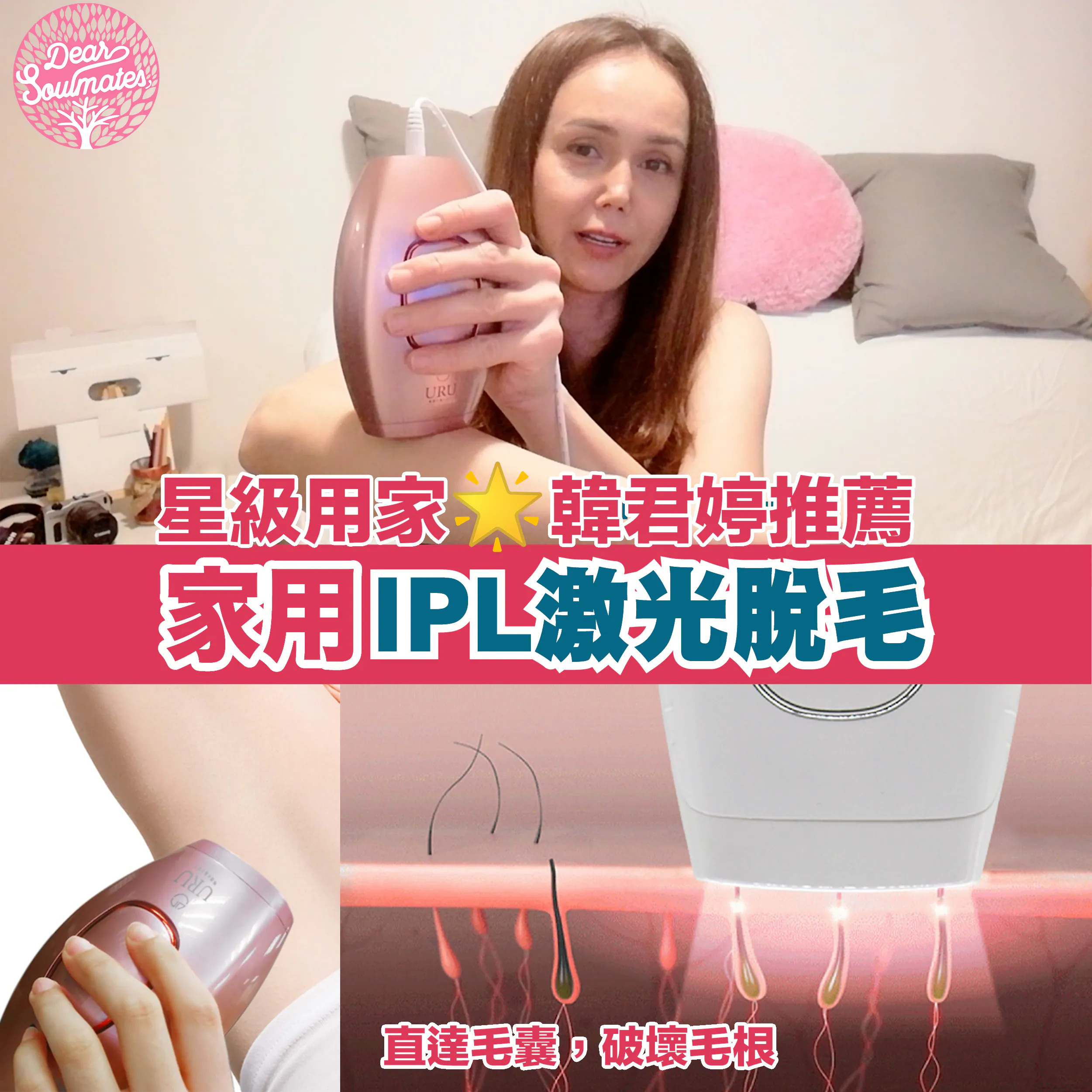 URU家用IPL激光脫毛機
