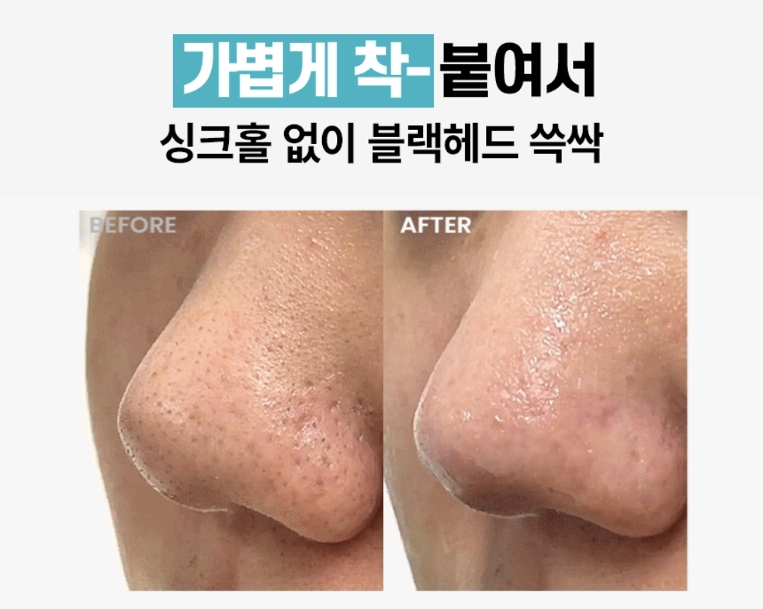 韓國ilso Natural Mild Clear Nose Pack 天然溫和清黑頭粉刺鼻貼 一盒5組