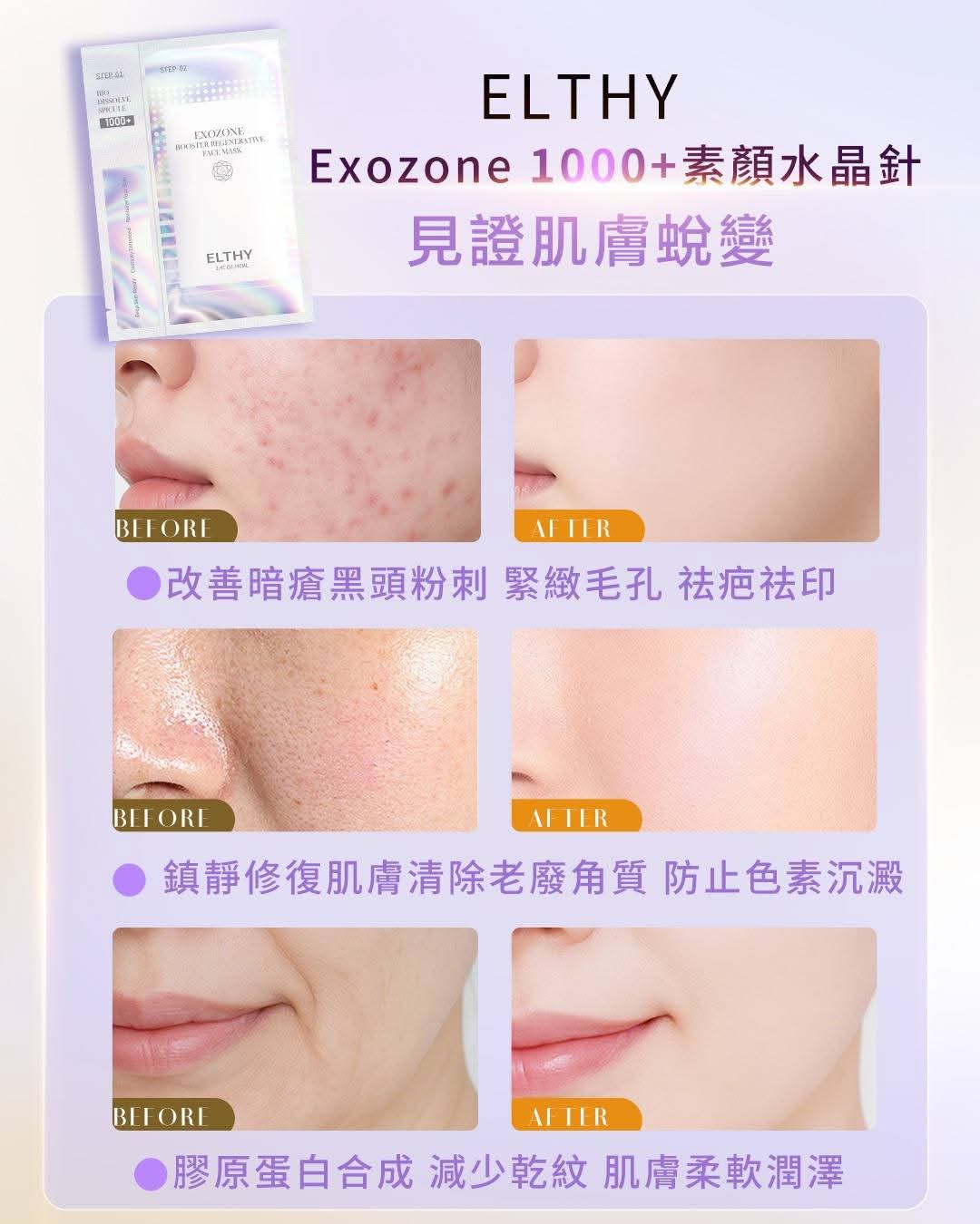 素顔水晶針(360元買一送一 共20片)