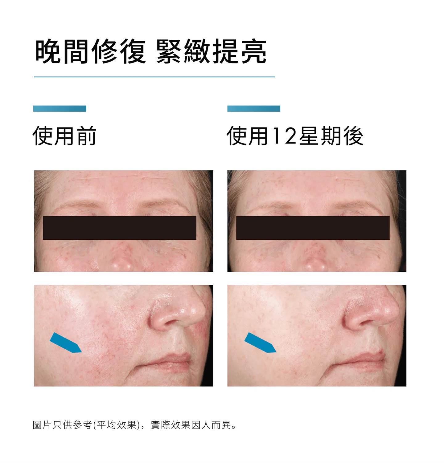 【SkinCeuticals】晚間抗氧修復精華30ml