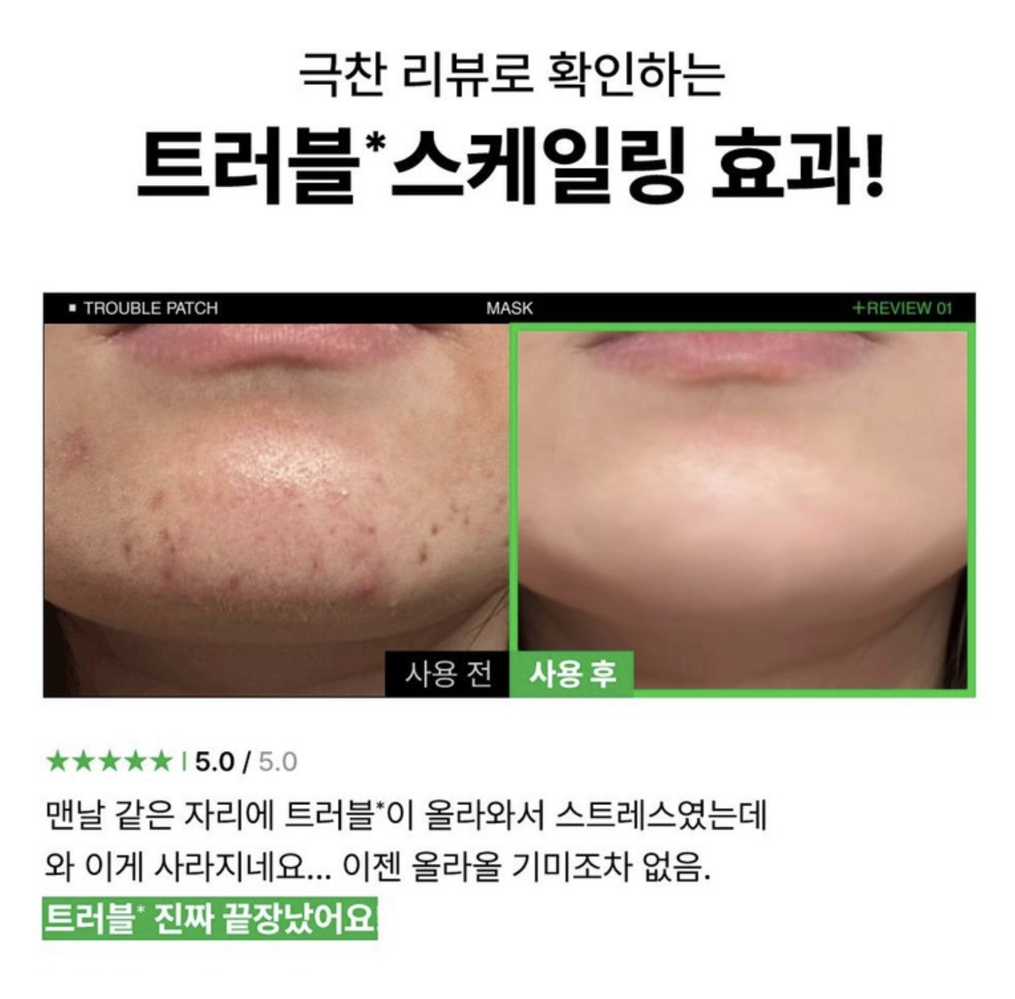 消炎吸皮脂｜韓國 EIOM 消炎祛痘 淨膚面膜 4片/盒｜Trouble Patch Mask