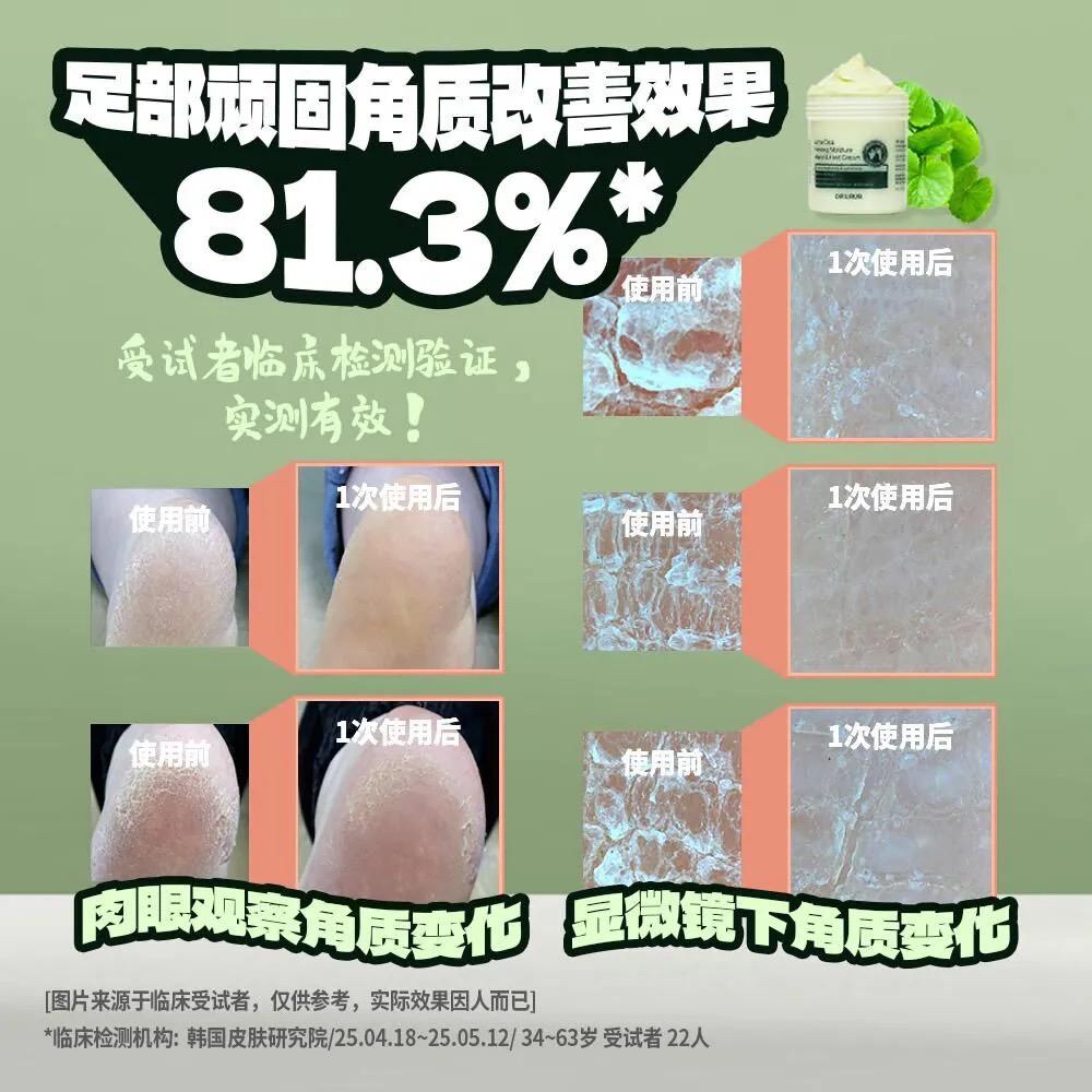 韓國🇰🇷直送@限時預購🔛Dr.URUR 積雪草修護手足霜150g