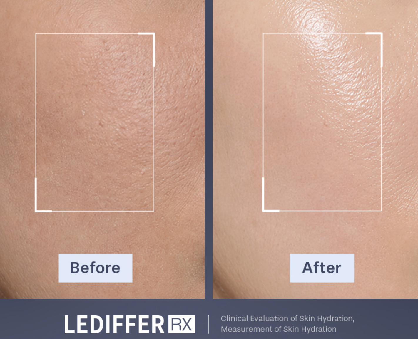 韓國 LEDIFFER RX 水光補水 / 美白提亮 / 緊緻抗衰 外泌體 精華 4.3ml / 支｜SKINBOOSTER SKINTONING SKINTOX