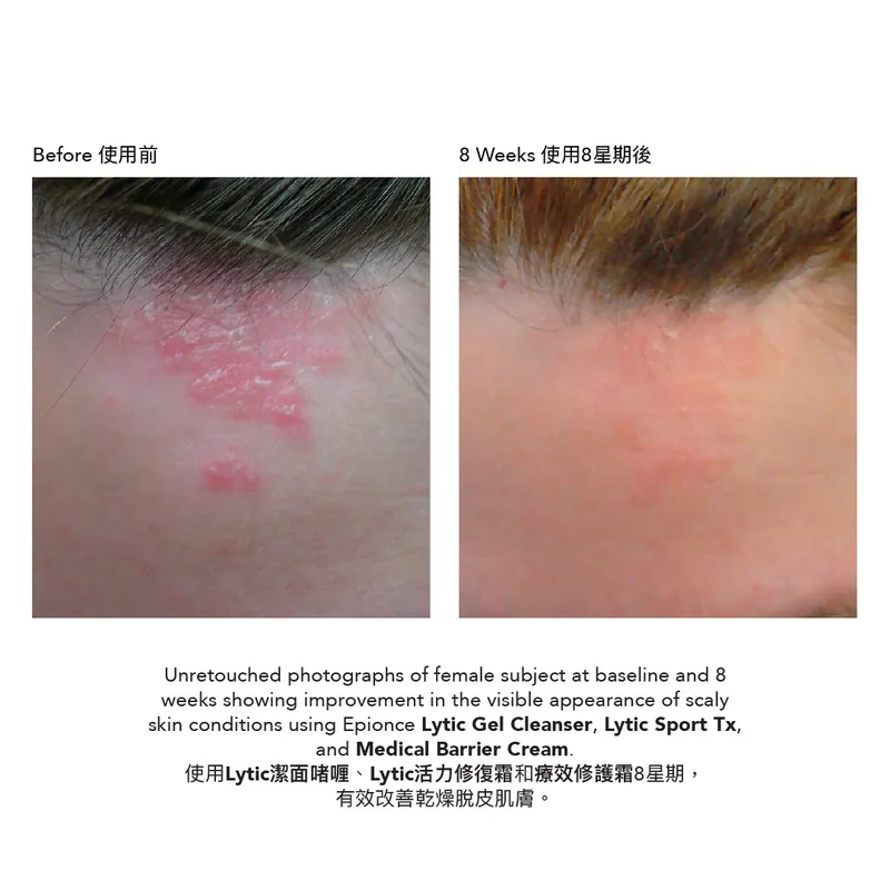 Epionce Lytic Sport Tx Retexturizing Lotion 活力修復霜