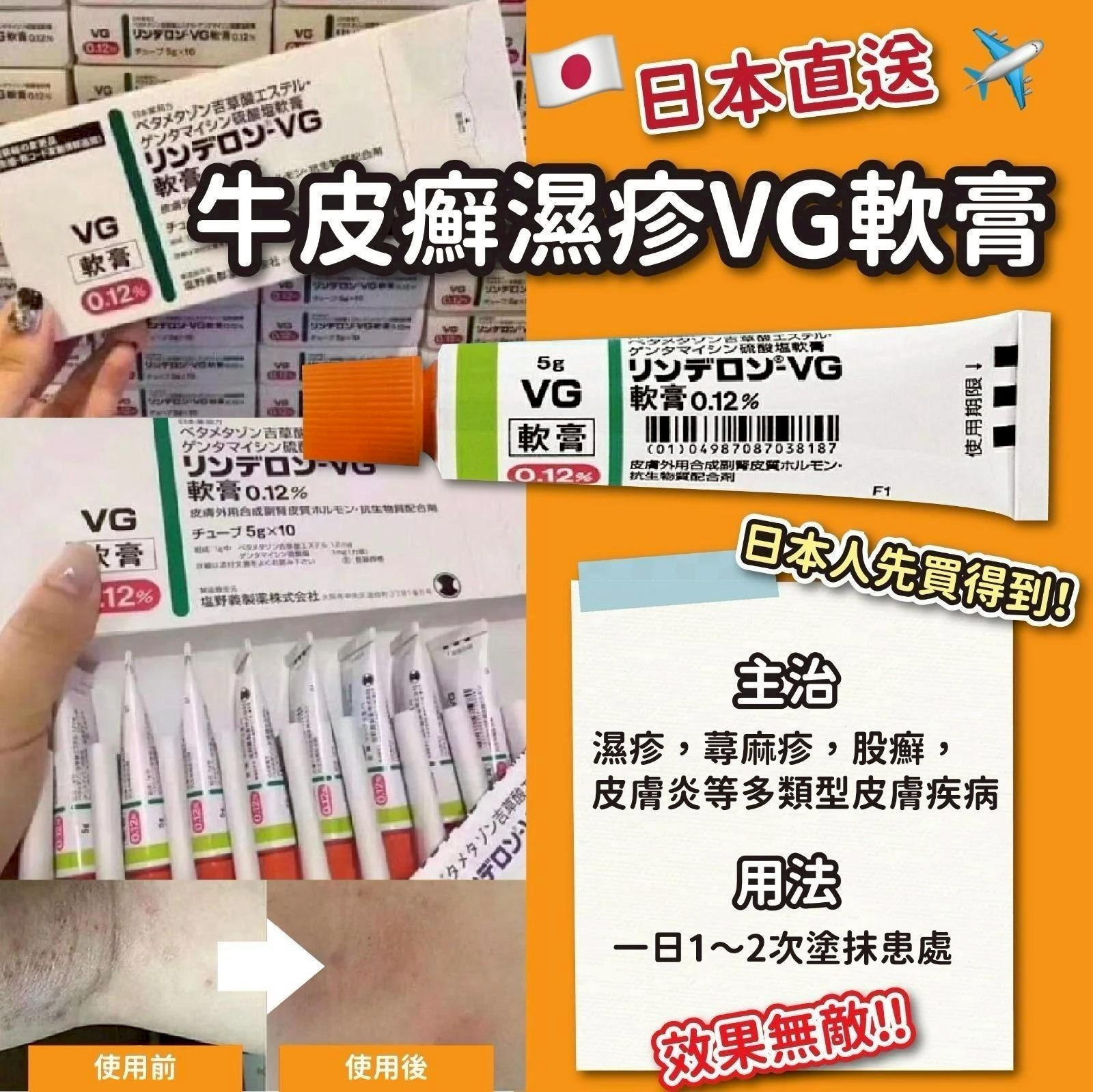＜限時預購＞日本牛皮癬濕疹VG軟膏(5g) TW260530S02 《2/6截單，預計6月下旬到港》