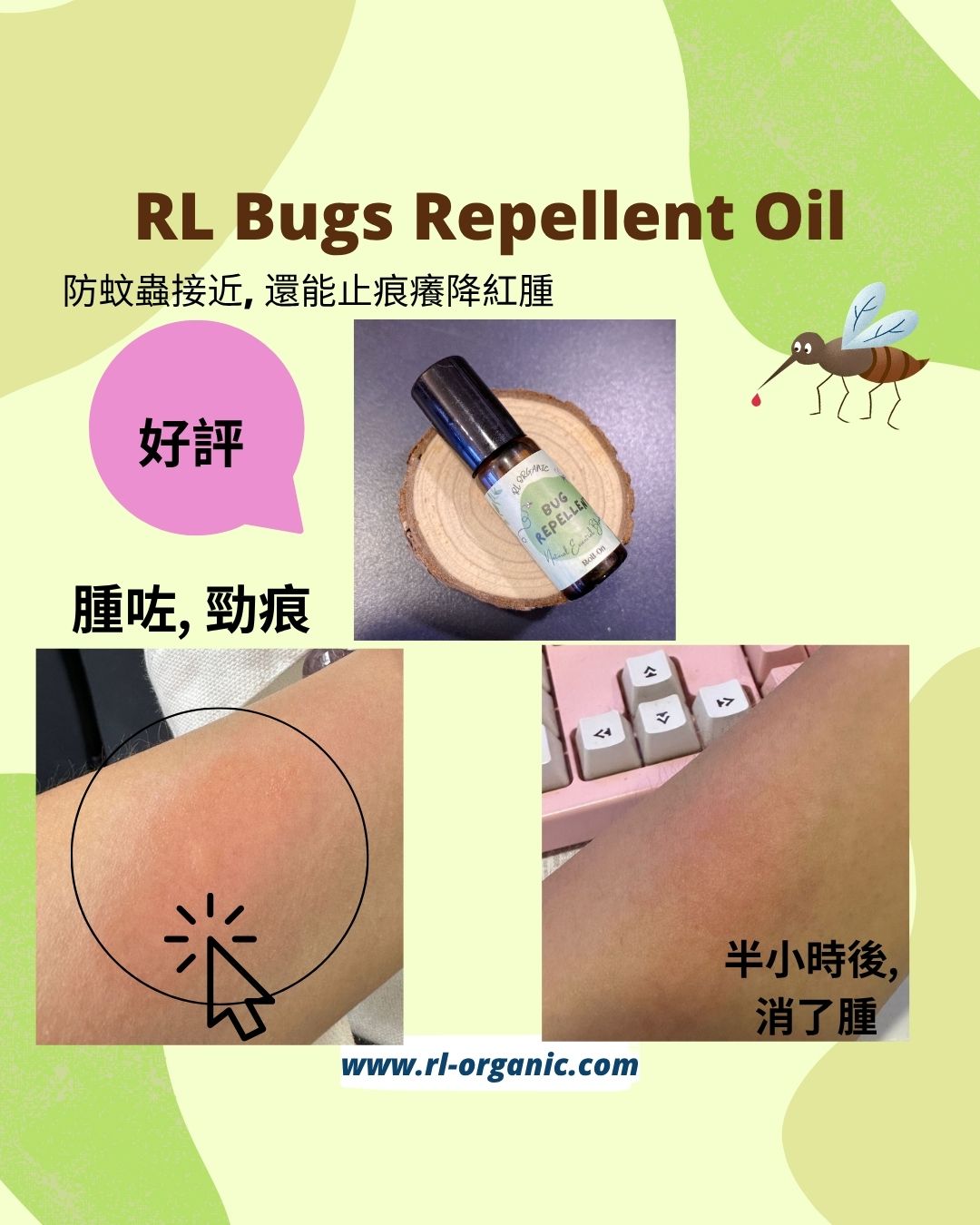 RL Breathe Out Love Bug Repellent  防蚊蟲止痕消腫 Roller 5/10ML