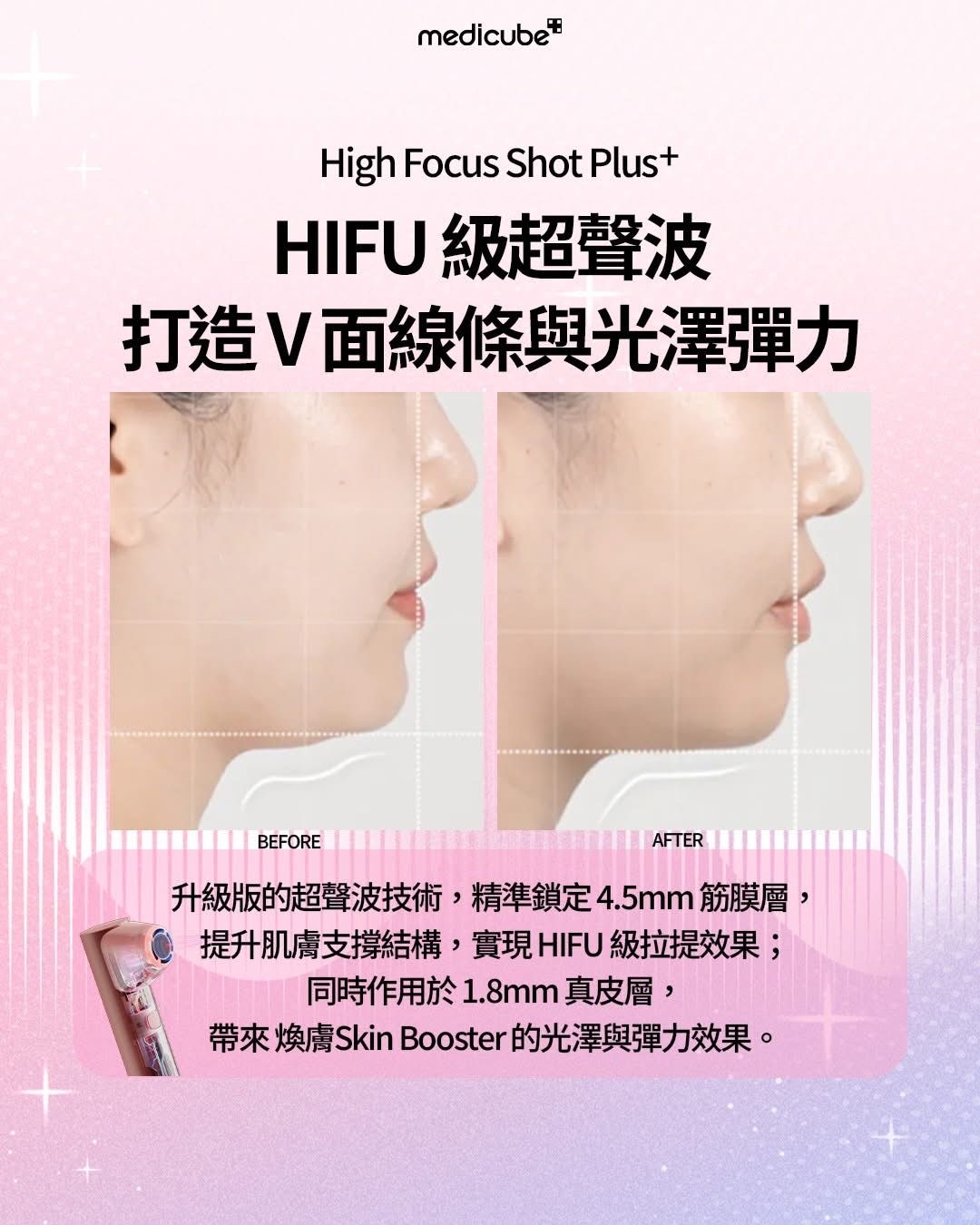 預訂預訂 MEDICUBE AGE-R High Focus Shot Plus [緊緻煥顏] 