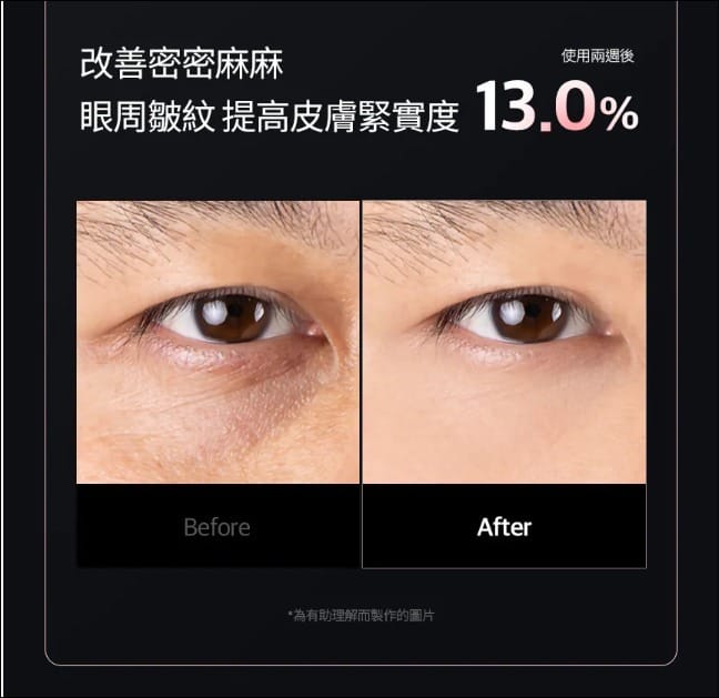 CELLOLOGY CELLNEWMER IRON 皺紋熨斗細胞機