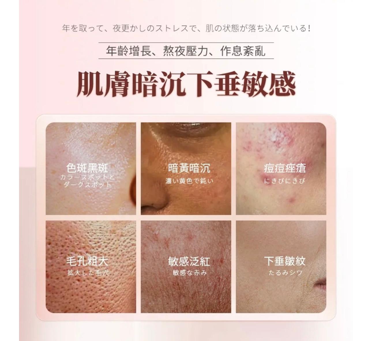 行貨1年保養JUJY 升級版逆齡煥膚美光機 PRO包面膜5片 