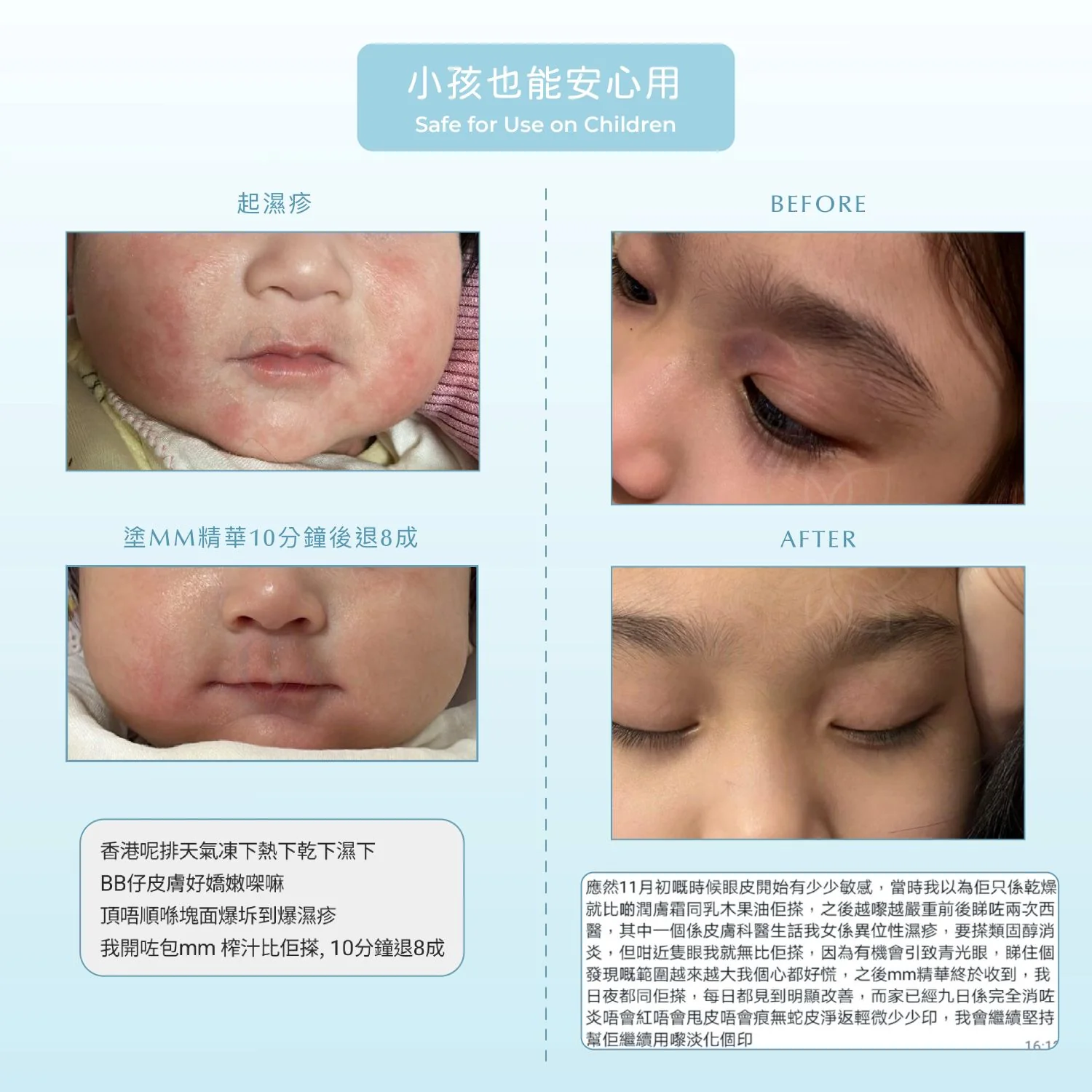 Hydro-boost Mask 醫學級玻色因專利保濕天絲面膜