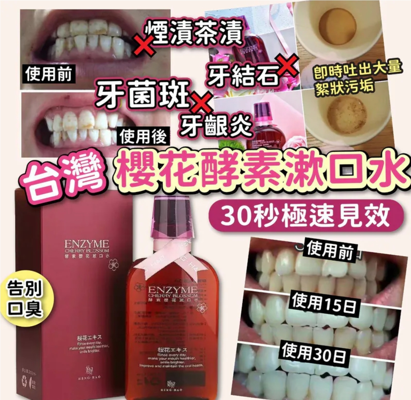 $49支。2支或以上:$40支。台灣櫻花酵素漱口水 350ml