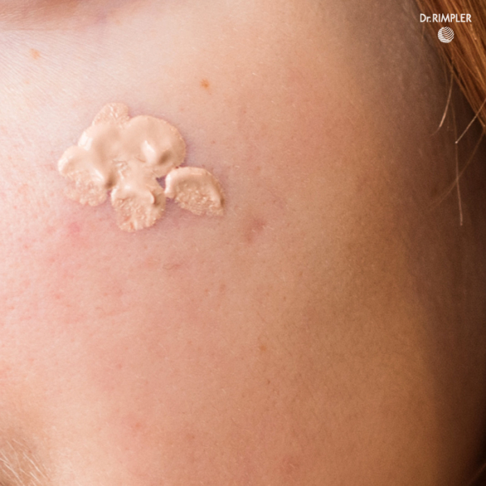 BASIC CLEAR+ THE SPOTLESS (ANTISEPTIC), 10ml