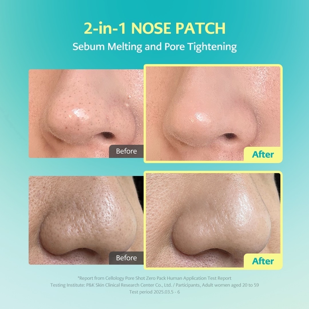 *Cellology PORE SHOT 毛孔狙擊ZERO貼片8入*