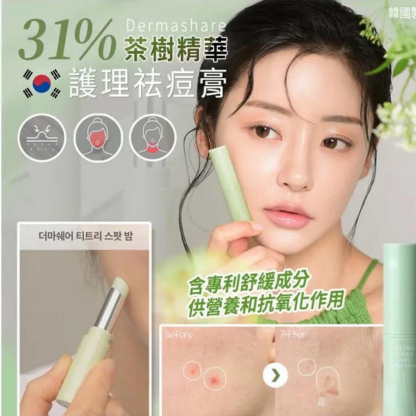 🇰🇷韓國 Dermashare 31%茶樹精華惱護理祛痘膏3.5g