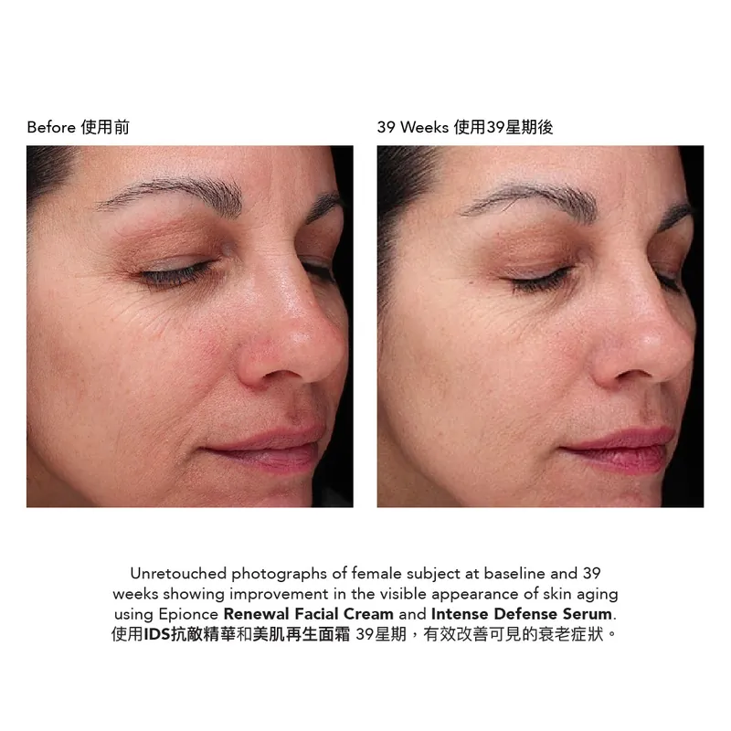 Epionce Intense Defense Serum IDS 抗敵精華